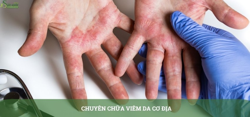 cay-sai-dat-chua-viem-da-co-dia-1323-3213