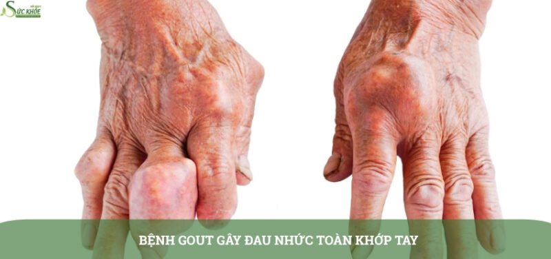 dau-cac-khop-ngon-tay2-3123