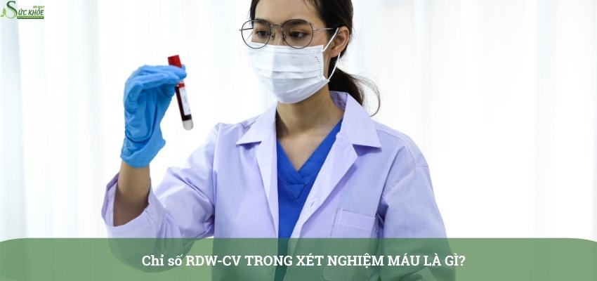 chi-so-rdw-cv-trong-xet-nghiem-mau-la-gi-3123