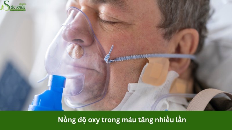 oxy-cao-ap-la-gi1-4234