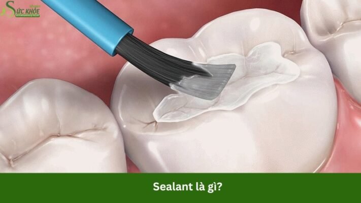 sealant-la-gi-3123