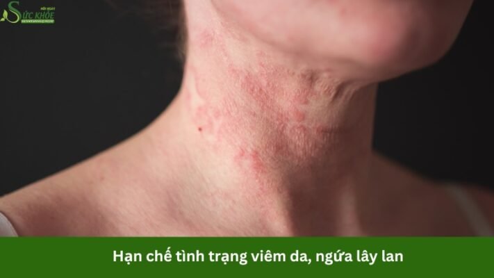 tratrison-la-thuoc-gi2-3213