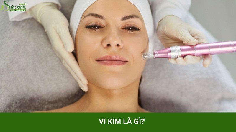 vi-kim-la-gi-3123123