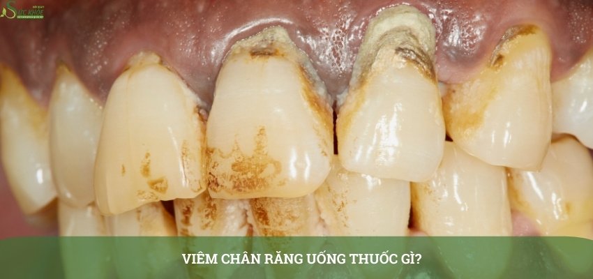viem-chan-rang-dung-thuoc-gi-3123213