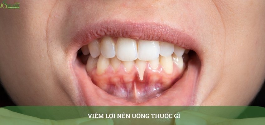 viem-loi-nen-uong-thuoc-gi-45345