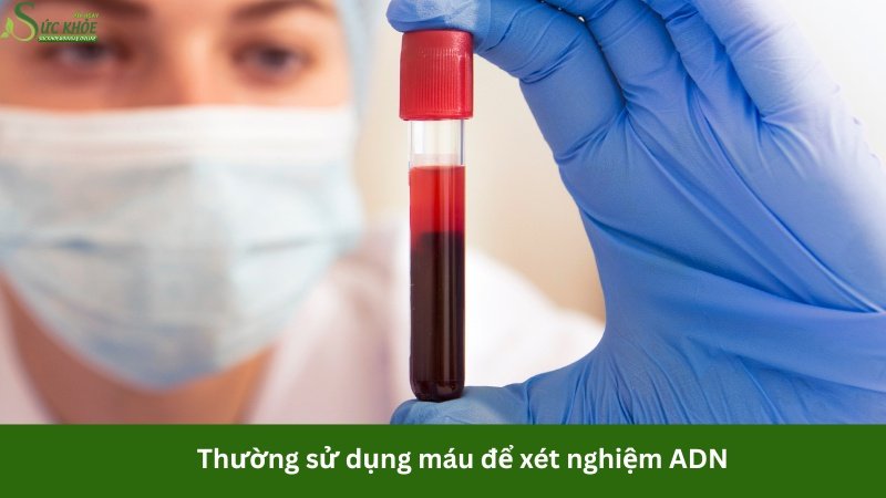 xet-nghiem-adn-can-nhung-gi1-3123123